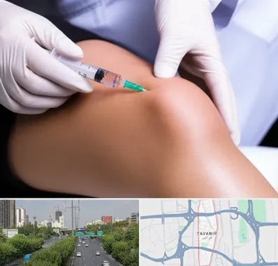 پلاسما درمانی PRP در توانیر