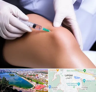 پلاسما درمانی PRP در لاهیجان