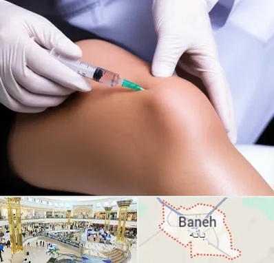 پلاسما درمانی PRP در بانه
