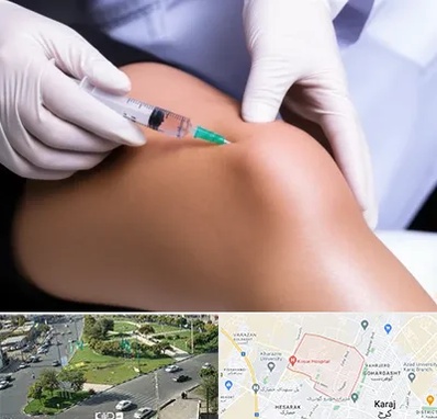 پلاسما درمانی PRP در شاهین ویلا کرج 