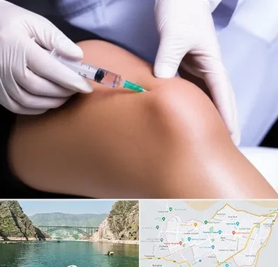 پلاسما درمانی PRP در ایلام