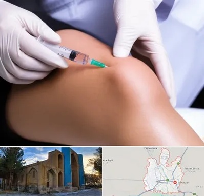 پلاسما درمانی PRP در اهر