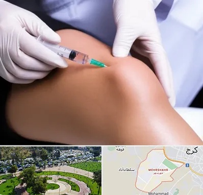 پلاسما درمانی PRP در مهرشهر کرج 