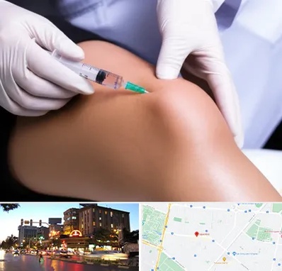 پلاسما درمانی PRP در بلوار سجاد مشهد 