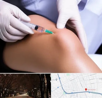 پلاسما درمانی PRP در ابوریحان تبریز 