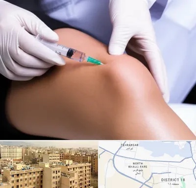 پلاسما درمانی PRP در جنوب غرب تهران