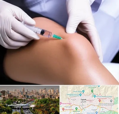 پلاسما درمانی PRP در منطقه 1 تهران 