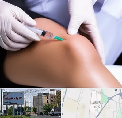 پلاسما درمانی PRP در فاز یک اندیشه