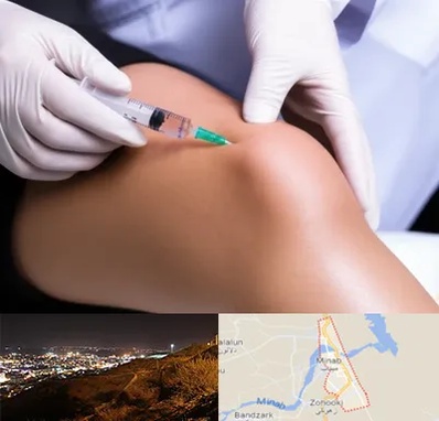 پلاسما درمانی PRP در میناب