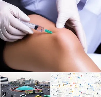پلاسما درمانی PRP در میدان انقلاب