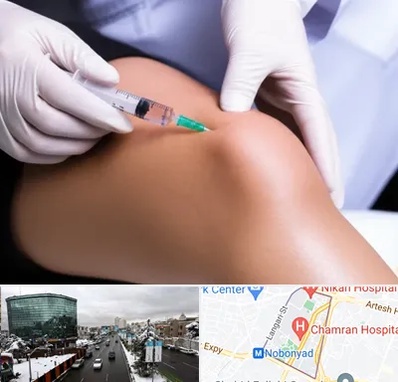 پلاسما درمانی PRP در اقدسیه 