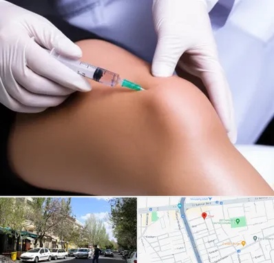 پلاسما درمانی PRP در کوی فیروز تبریز 