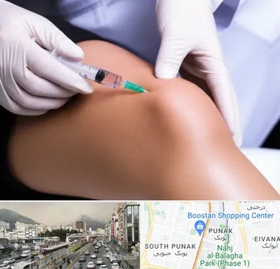 پلاسما درمانی PRP در پونک 