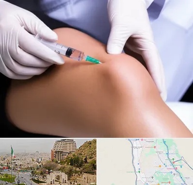 پلاسما درمانی PRP در فرهنگ شهر شیراز 