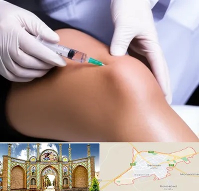 پلاسما درمانی PRP در سمنان