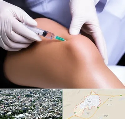 پلاسما درمانی PRP در شاهرود