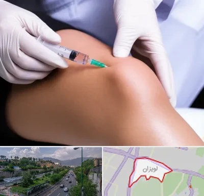 پلاسما درمانی PRP در لویزان