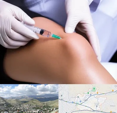 پلاسما درمانی PRP در رودهن