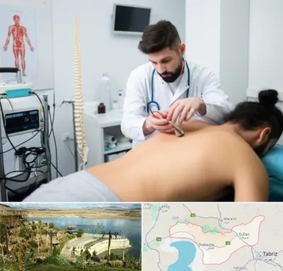 کلینیک درد در شبستر