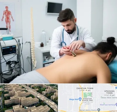 کلینیک درد در اکباتان 