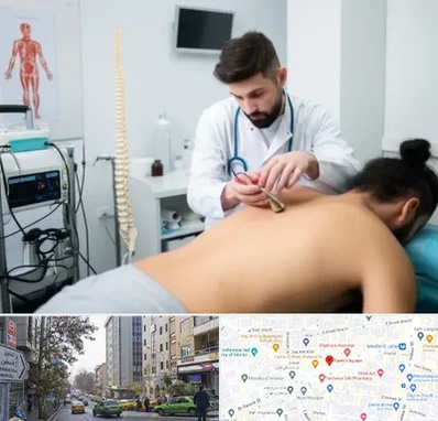 کلینیک درد در فاطمی 