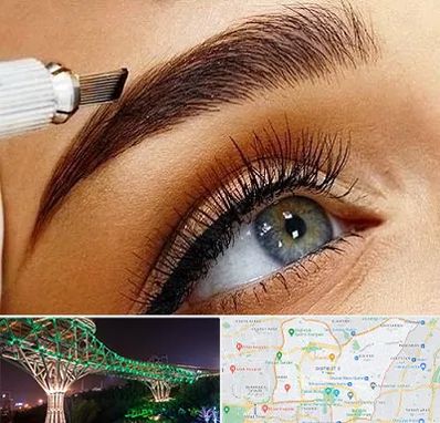 فیبروز ابرو در منطقه 3 تهران