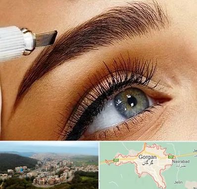 فیبروز ابرو در گرگان