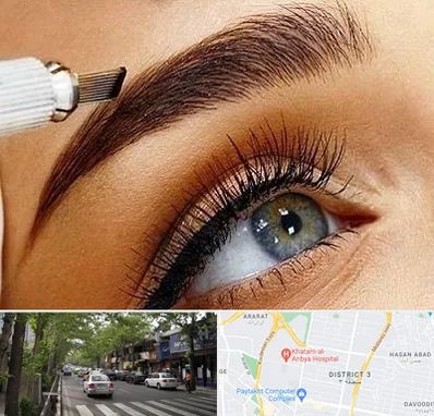 فیبروز ابرو در ظفر