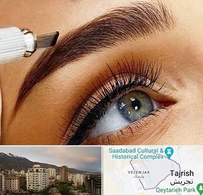 فیبروز ابرو در زعفرانیه