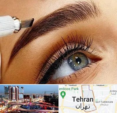 فیبروز ابرو در صادقیه 