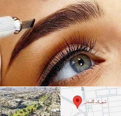 فیبروز ابرو در شهرک گلستان