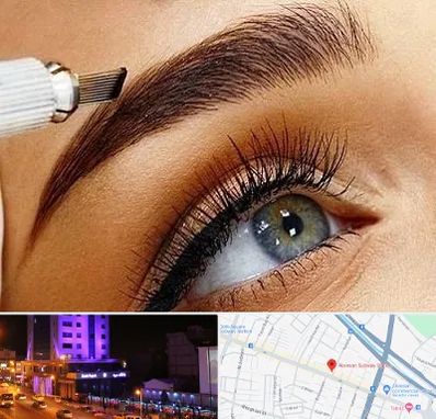 فیبروز ابرو در آبرسان تبریز