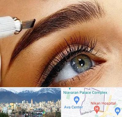 فیبروز ابرو در آجودانیه