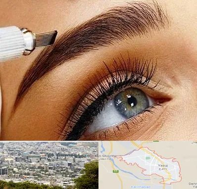 فیبروز ابرو در یاسوج