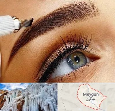 فیبروز ابرو در میگون