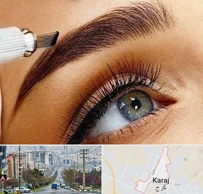 فیبروز ابرو در گوهردشت