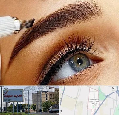 فیبروز ابرو در فاز یک اندیشه