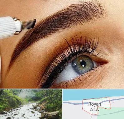 فیبروز ابرو در رویان