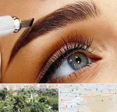 فیبروز ابرو در منطقه 13 تهران