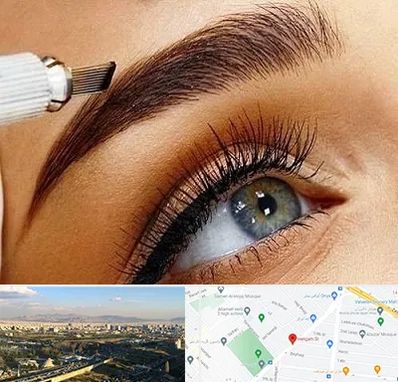 فیبروز ابرو در هنگام