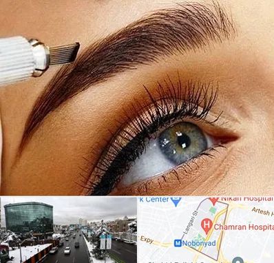 فیبروز ابرو در اقدسیه