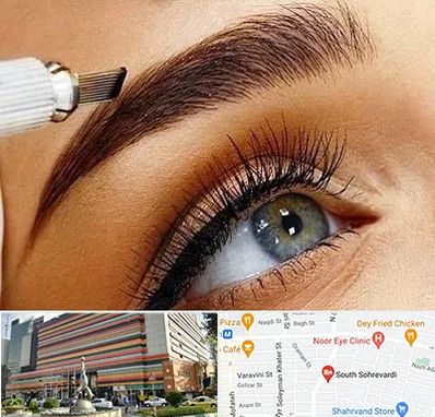 فیبروز ابرو در سهروردی