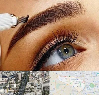 فیبروز ابرو در منطقه 18 تهران