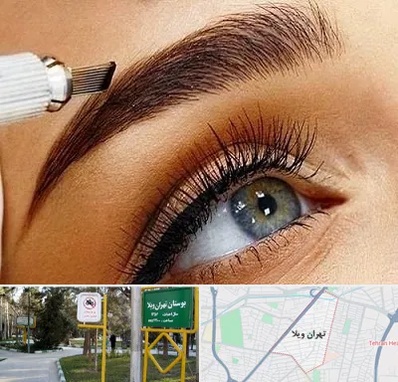 فیبروز ابرو در تهران ویلا