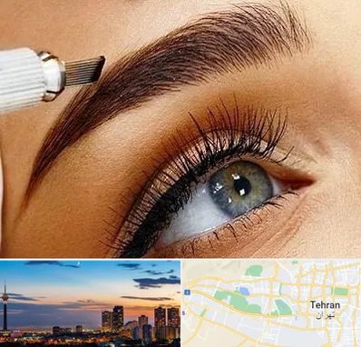 فیبروز ابرو در غرب تهران 