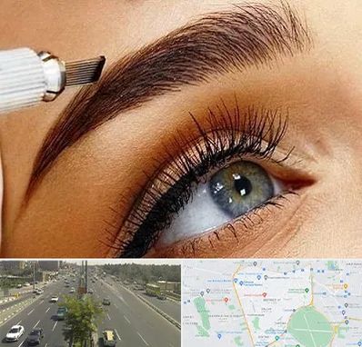 فیبروز ابرو در منطقه 17 تهران