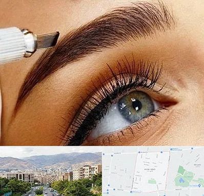 فیبروز ابرو در خانی آباد