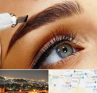 فیبروز ابرو در مارلیک کرج