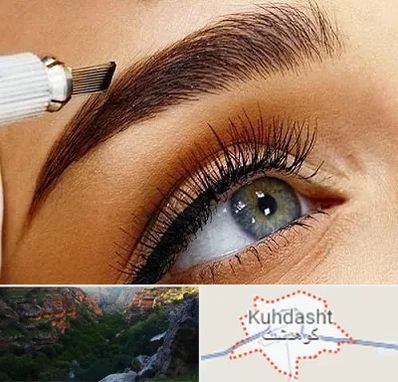 فیبروز ابرو در کوهدشت