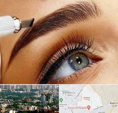 فیبروز ابرو در عظیمیه کرج